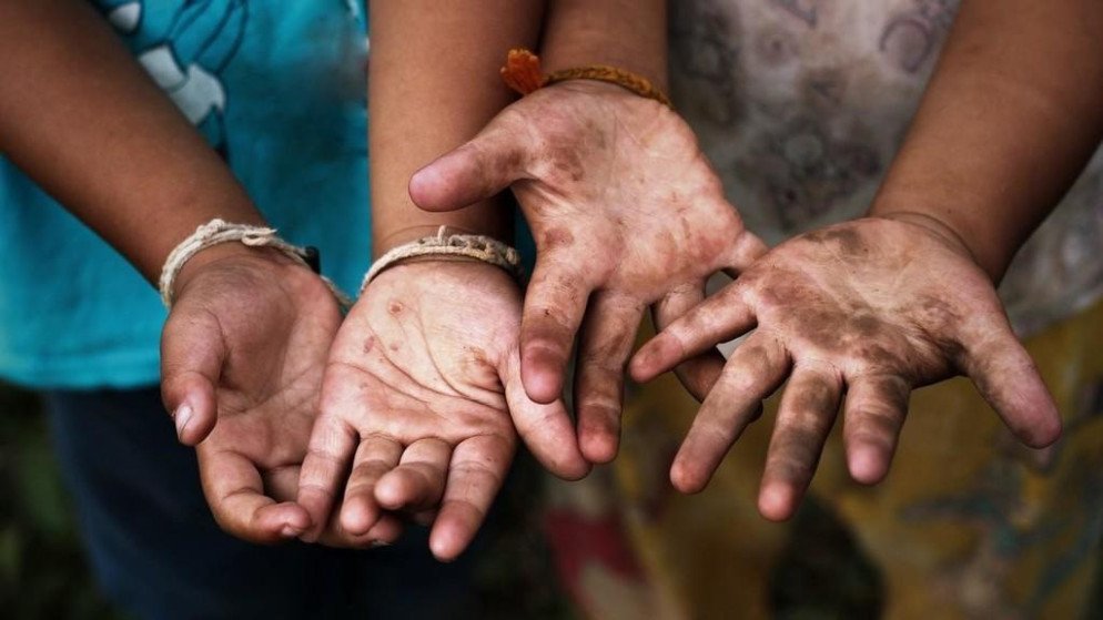 مركز حقوق الإنسان: 75 ألف طفل توثق أنهم يعملون بصورة غير قانونية